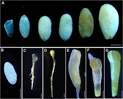 Transcriptomic Time-Series Analyses of Gene Expression Profile During Zygotic Embryo Development in Picea mongolica